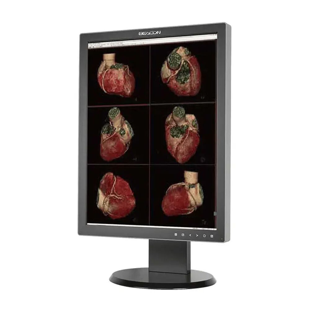 Beacon C310S 21.3" 3MP Color LED Diagnostic Radiology Display Monitor