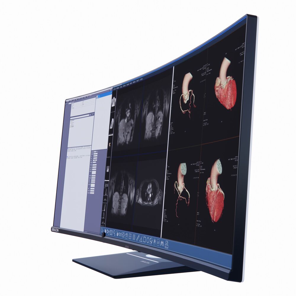 Beacon C610W 37.5" 6MP Integrated Three-Screen Diagnostic Display Monitor