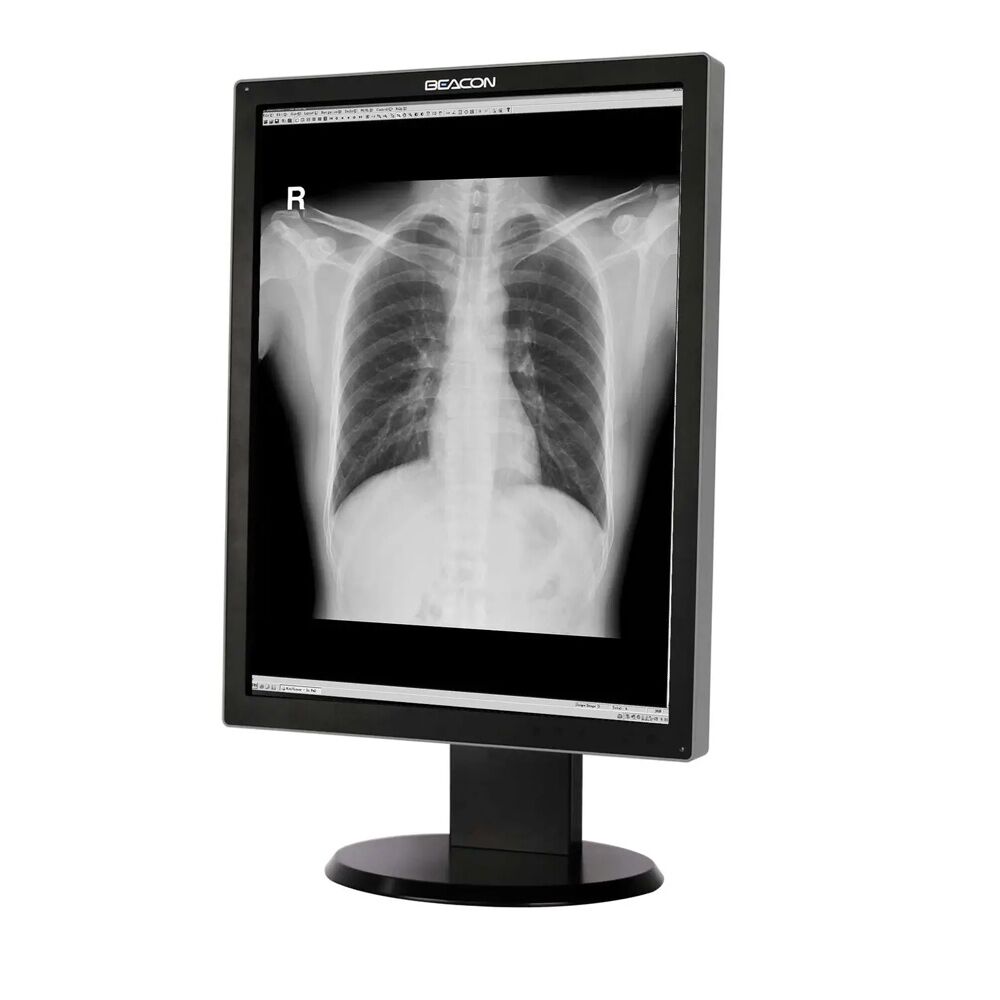 Beacon G310S 21.3" 3MP Monochrome LED Diagnostic Radiology Display Monitor