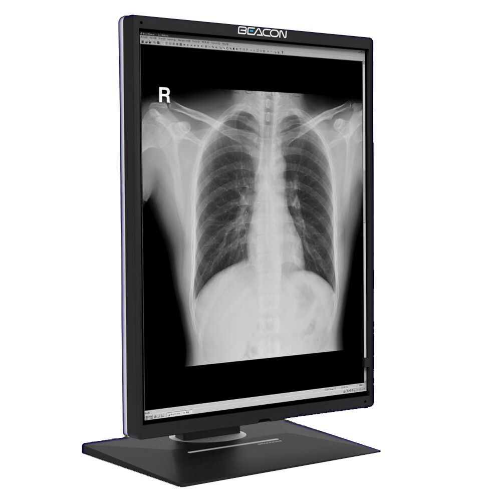 Beacon G316S 21.3" 3MP Monochrome LED Diagnostic Radiology Display Monitor