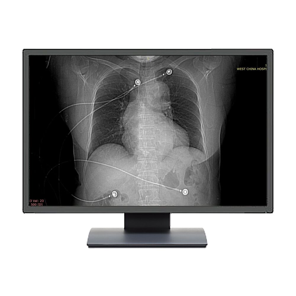 Beacon HL2316SHTB 23.8" Multifunction Clinical Review Monitor