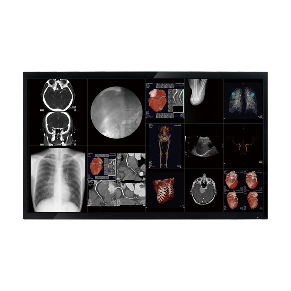 Optik View DC4081X 40" 4K Surgical Display Monitor