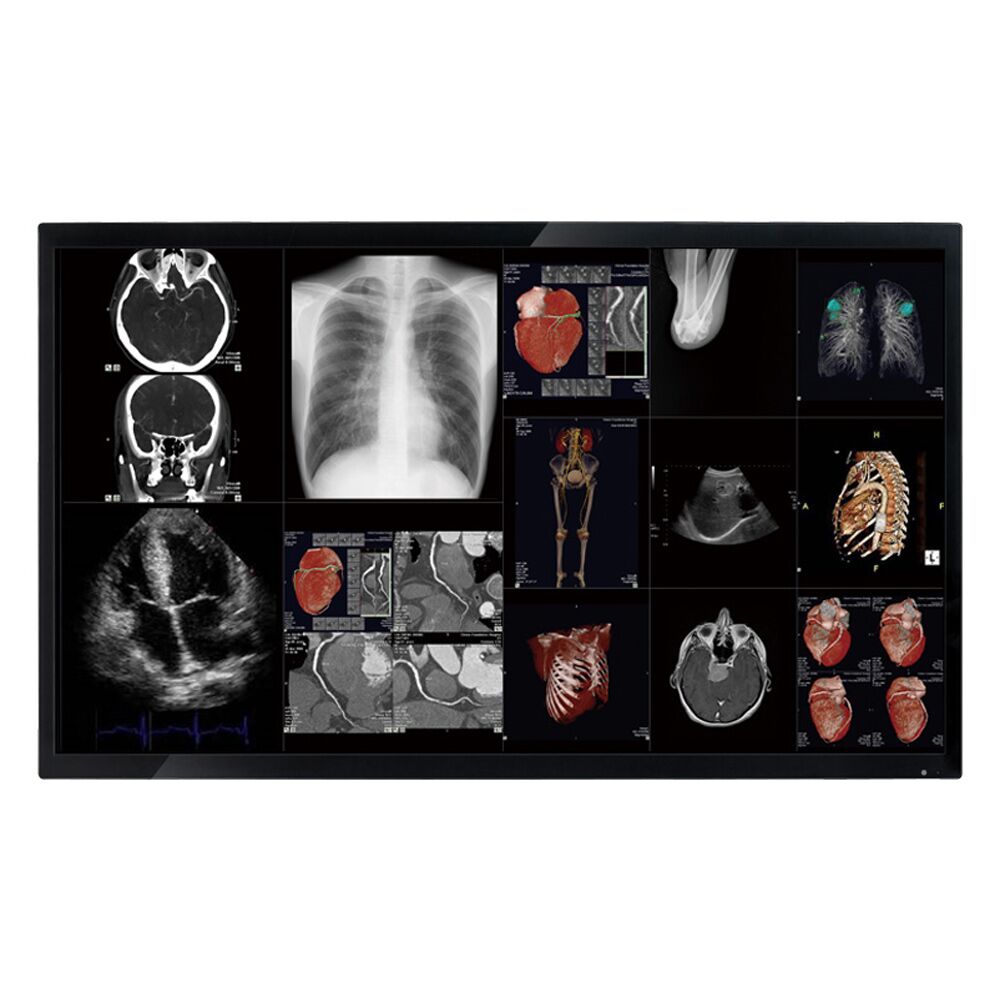 Optik View DC5811 58" Surgical Monitor