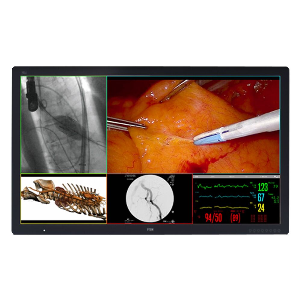 FSN FM-D5802DV 58-inch 4K UHD Surgical Monitor