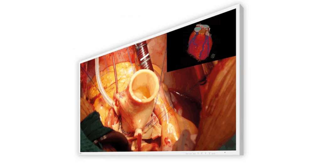 Eizo EX4342 Medical Display Monitor