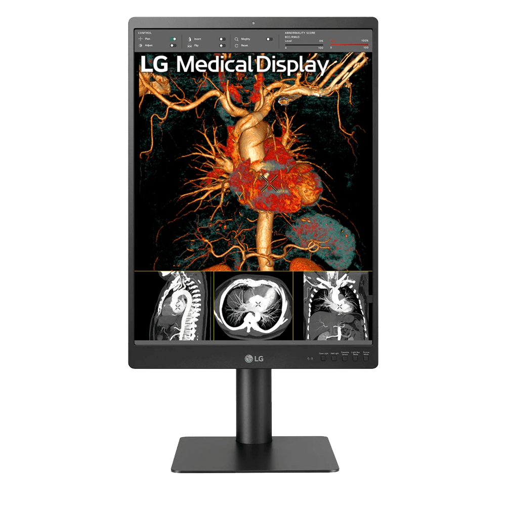 LG 21HQ513D-B 3MP Medical Display - 21HQ513DB