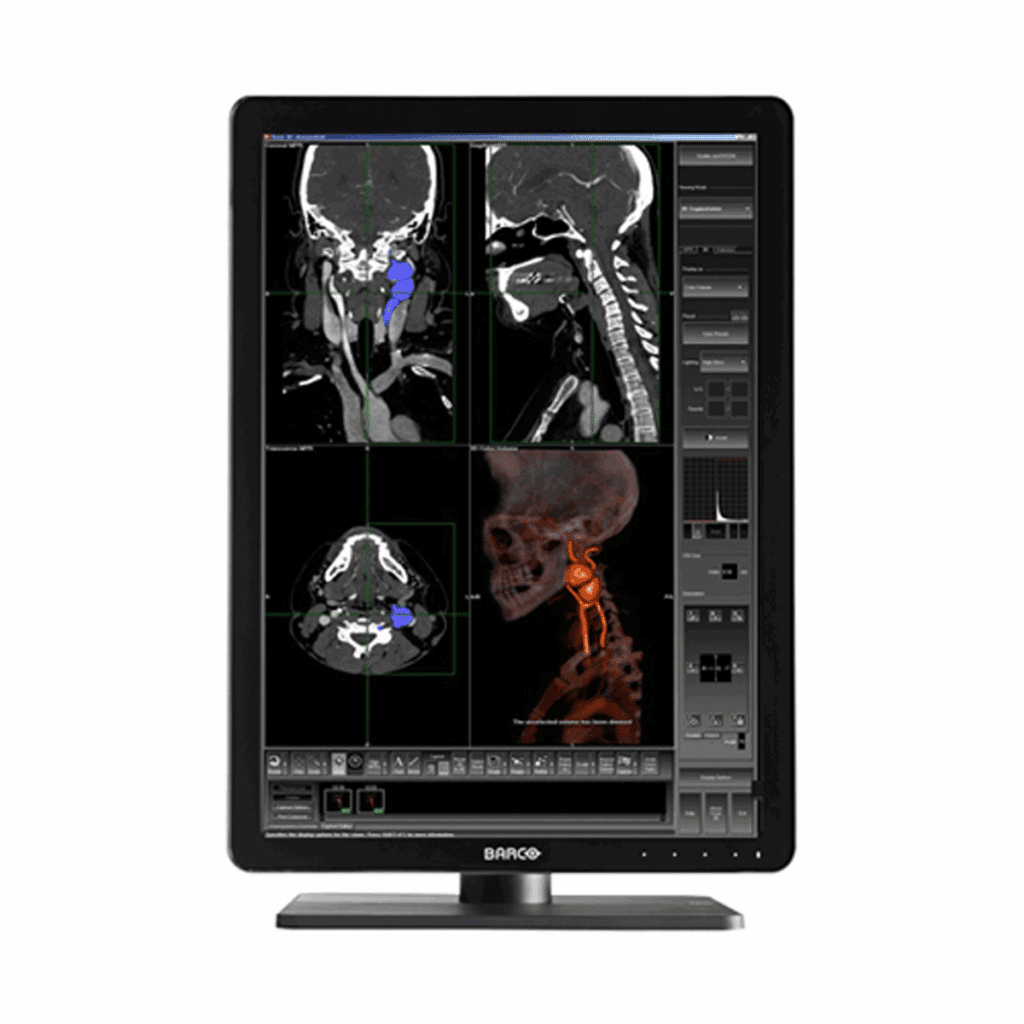 Barco MDNC-3421 Diagnostic Radiology Monitor - MDNC3421