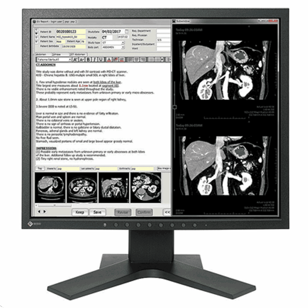 Eizo RadiForce MX194-BK Clinical Review Display - MX194BK