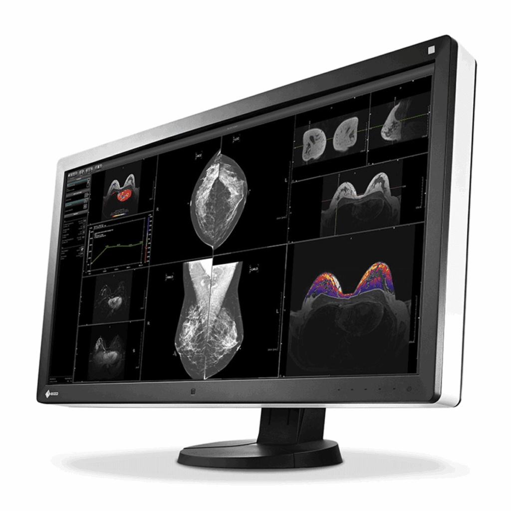 Eizo RX850-BK 8MP Diagnostic Radiology Monitor RX850BK