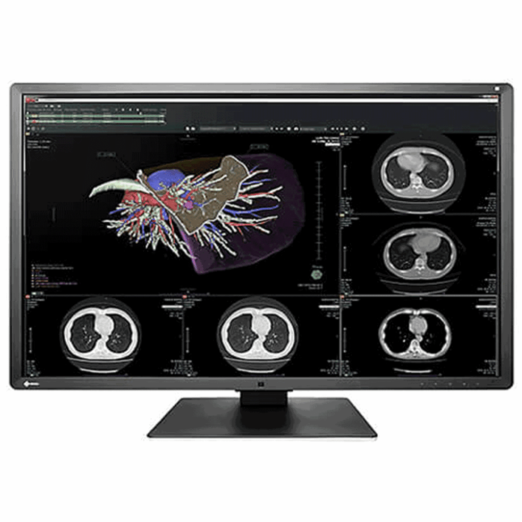 Eizo RX660-BK 6MP Medical Monitor
