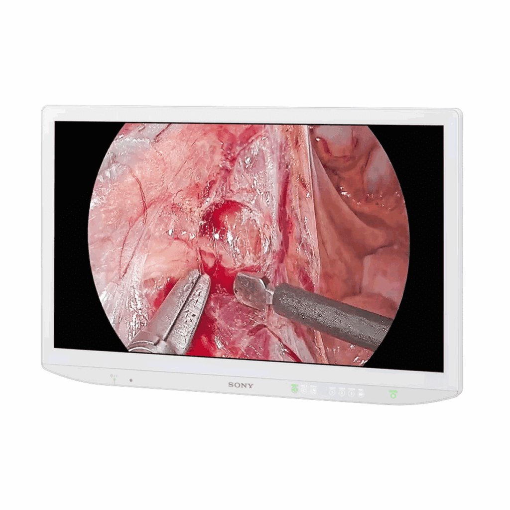 Sony LMD-27M1MD (LMD27M1MD) Surgical Display Monitor
