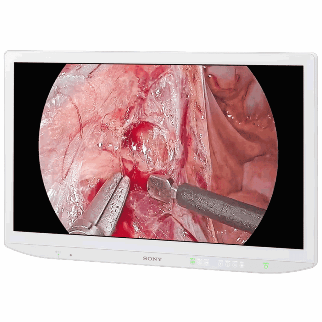 Sony LMD-43M1MD Surgical Display Monitor - LMD43M1MD