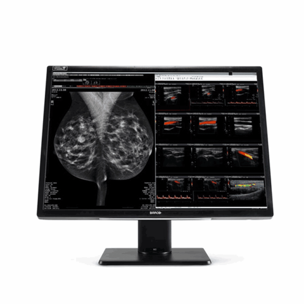 Barco MDNC-12130 Diagnostic Display - MDNC12130