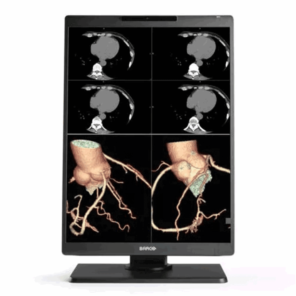 Barco MDNC-2521 Medical Display - MDNC2521
