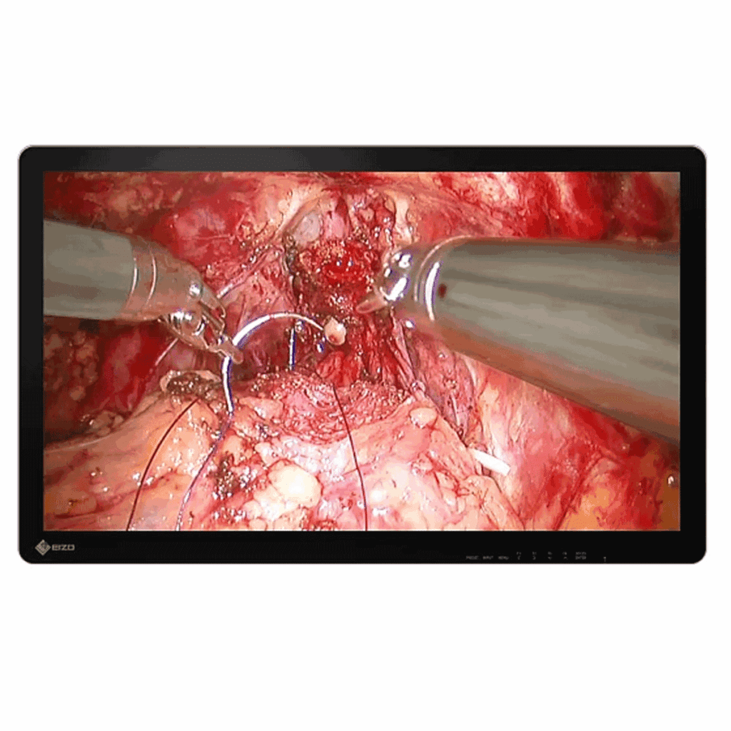 Eizo EX3242-3D Surgical Display - EX32423D