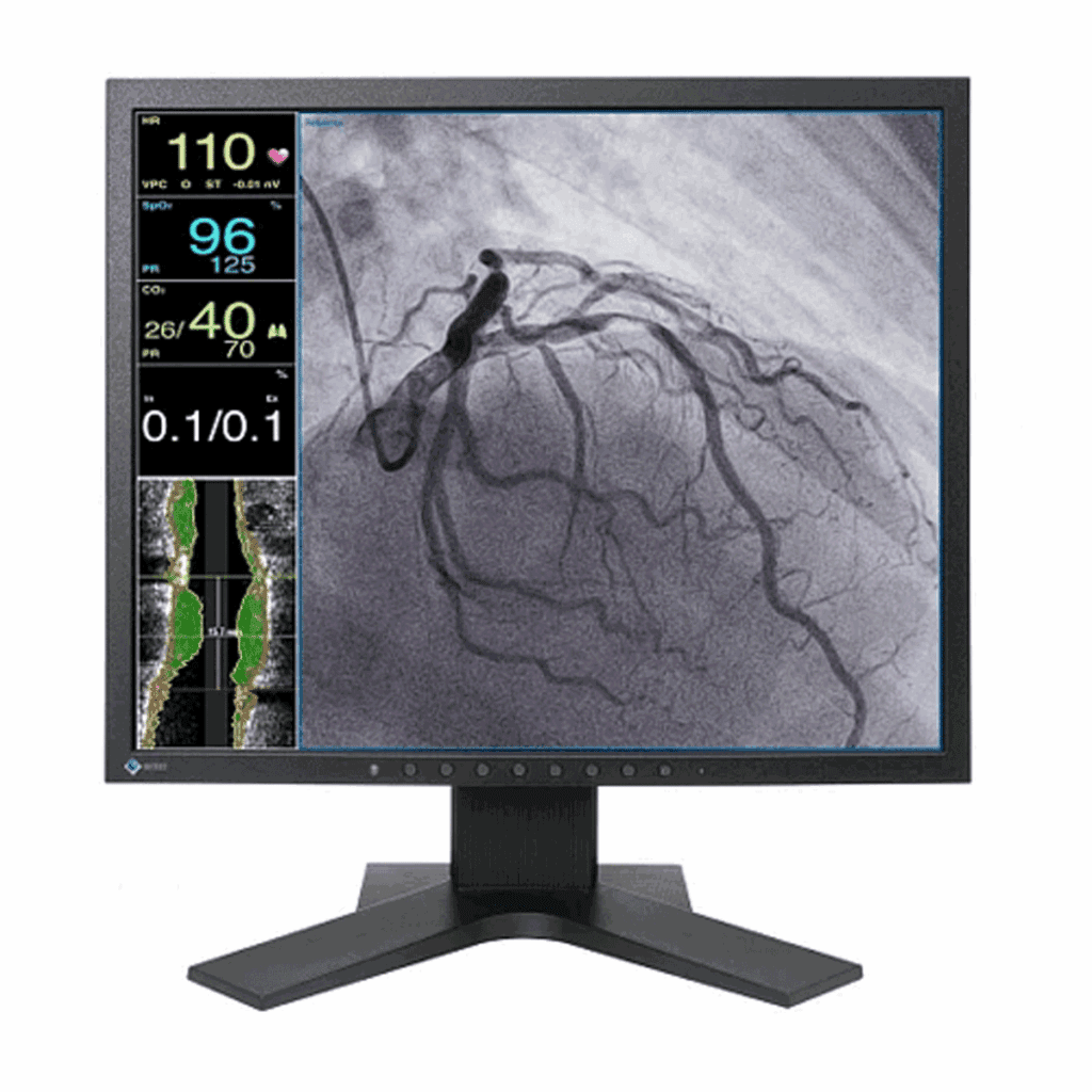 Eizo LX1910-S (LX1910S) Medical Display