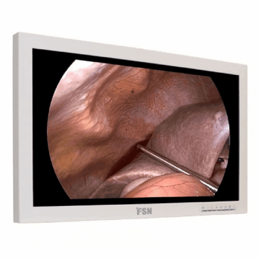 FSN FS-P2602D Surgical Display - FSP2602D