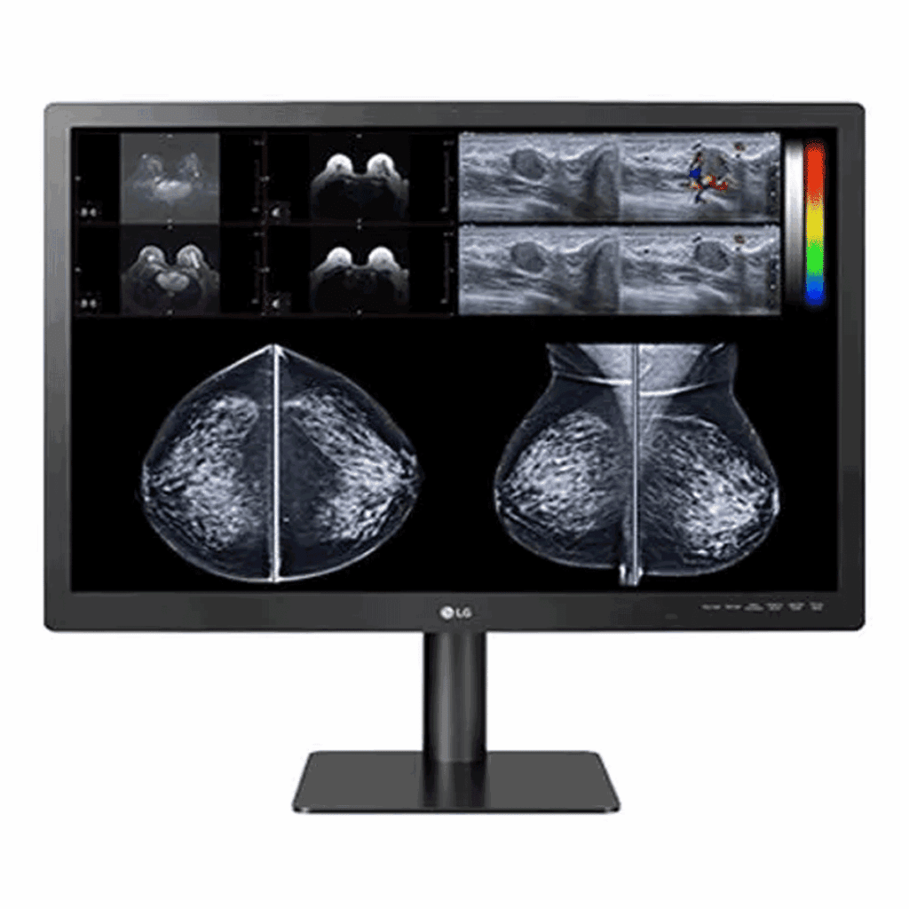 LG 31HN713D-B 12MP Diagnostic Display - 31HN713DB