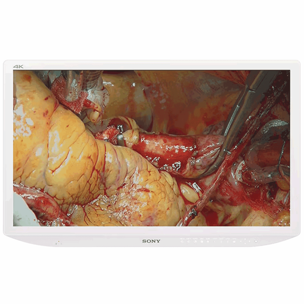 Sony LMD-X3200MD Surgical Display Monitor - LMDX3200MD