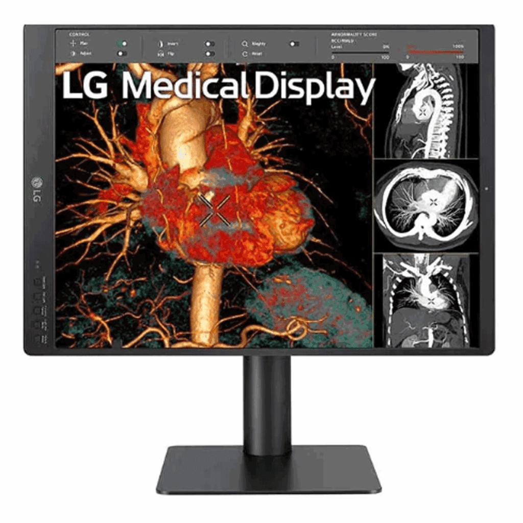 LG 21HQ513D-S 3MP Diagnostic Display - 21HQ513DS