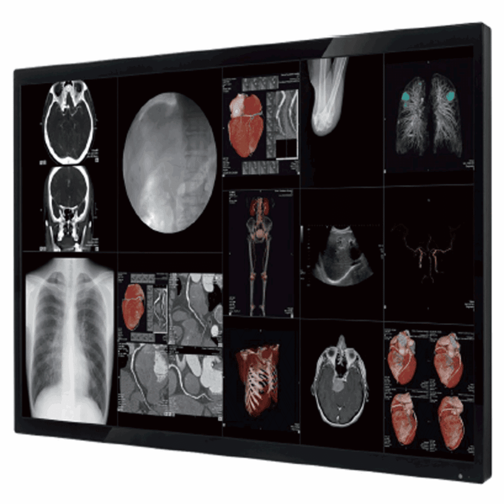 Optik View SC4384XX 4K Surgical Display - SC4384XX