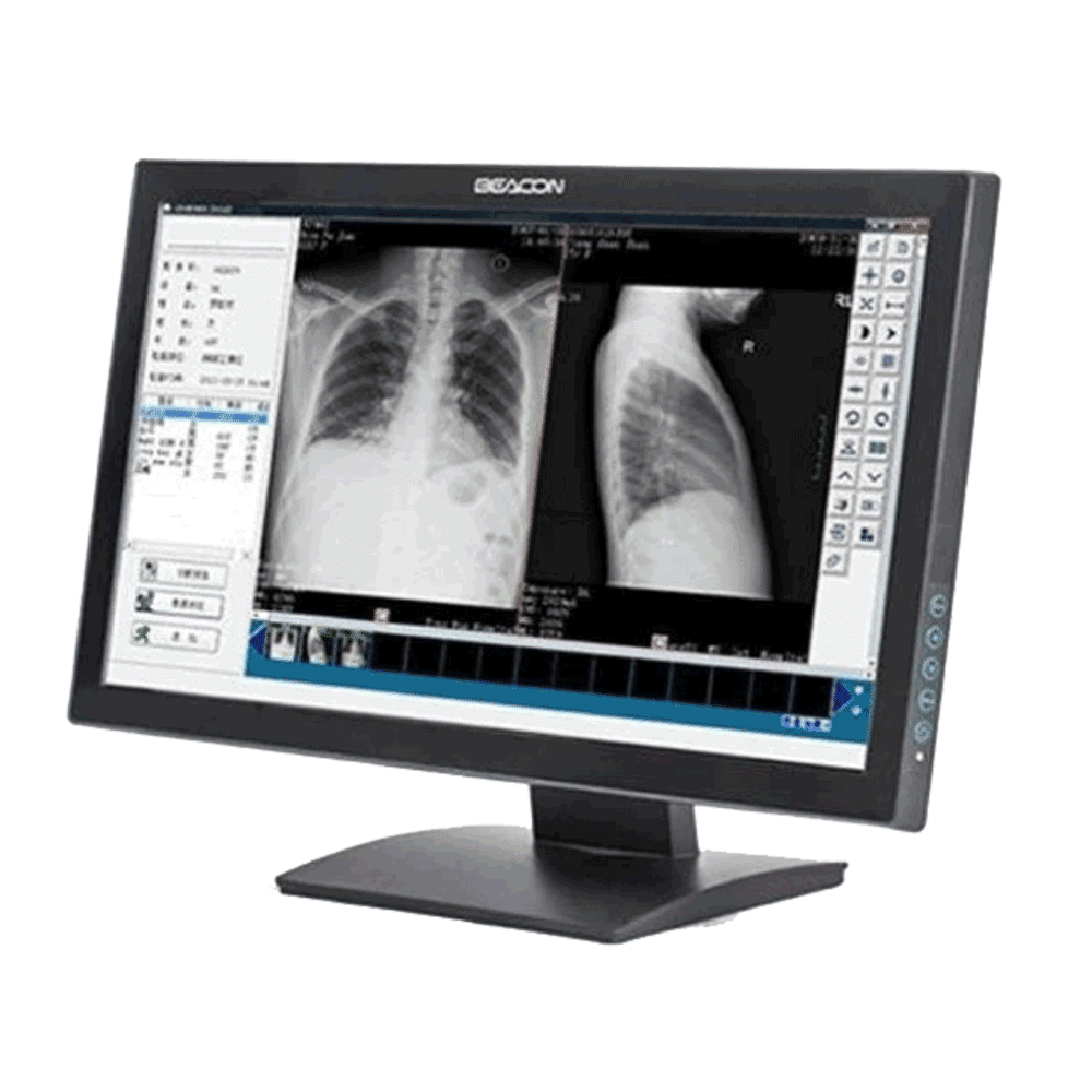 Beacon C24WT Clinical Review Display